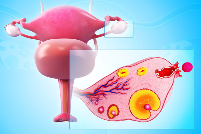 Эндометриоидные кисты яичников и матки thumbnail