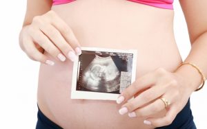 Как беременеть при кисте яичника